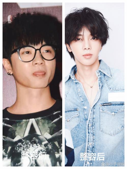 包含华晨宇整容网红前照片的词条